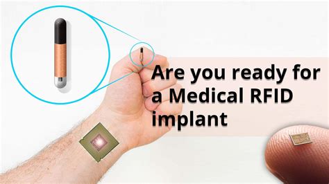 clearly you rfid chip|microchip vs rfid.